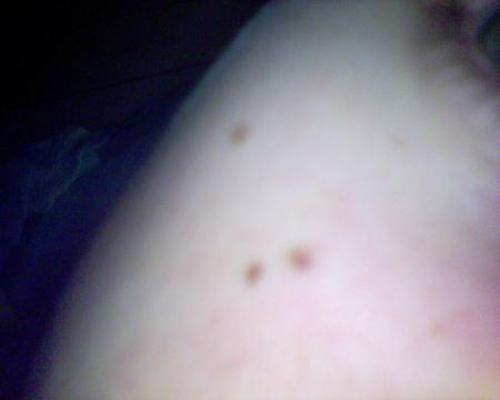 The 3 grains de beauté!!!